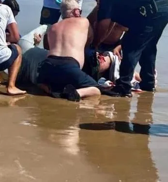 Video: Tiburón ataca a dos personas en Isla del Padre en Texas