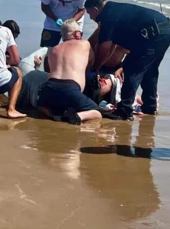 Video: Tiburón ataca a dos personas en Isla del Padre en Texas