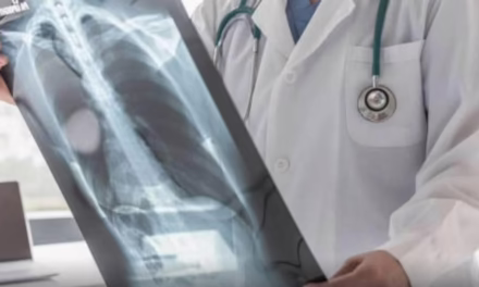 Si presentas tos durante más de dos semanas, es necesaria una evaluación para descartar tuberculosis.