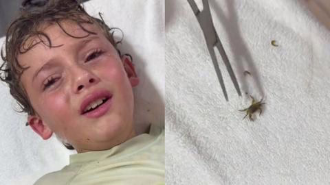 Video: En Cancún, le extraen a niño de la oreja un cangrejo!