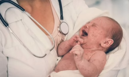 Salud asegura que no hay desabasto de vacunas contra sarampión