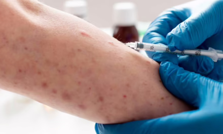 Síntomas, vacunas, prevención, todo lo que necesitas saber sobre como tratar el Sarampión