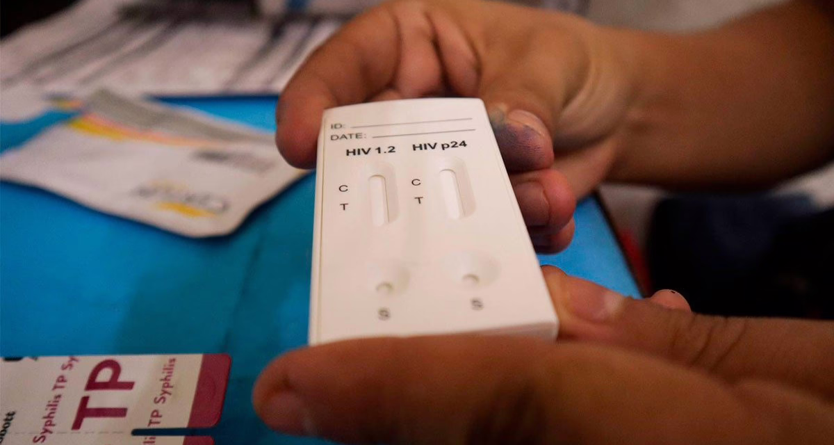 Estudio fortalece detección de cáncer en pacientes con VIH